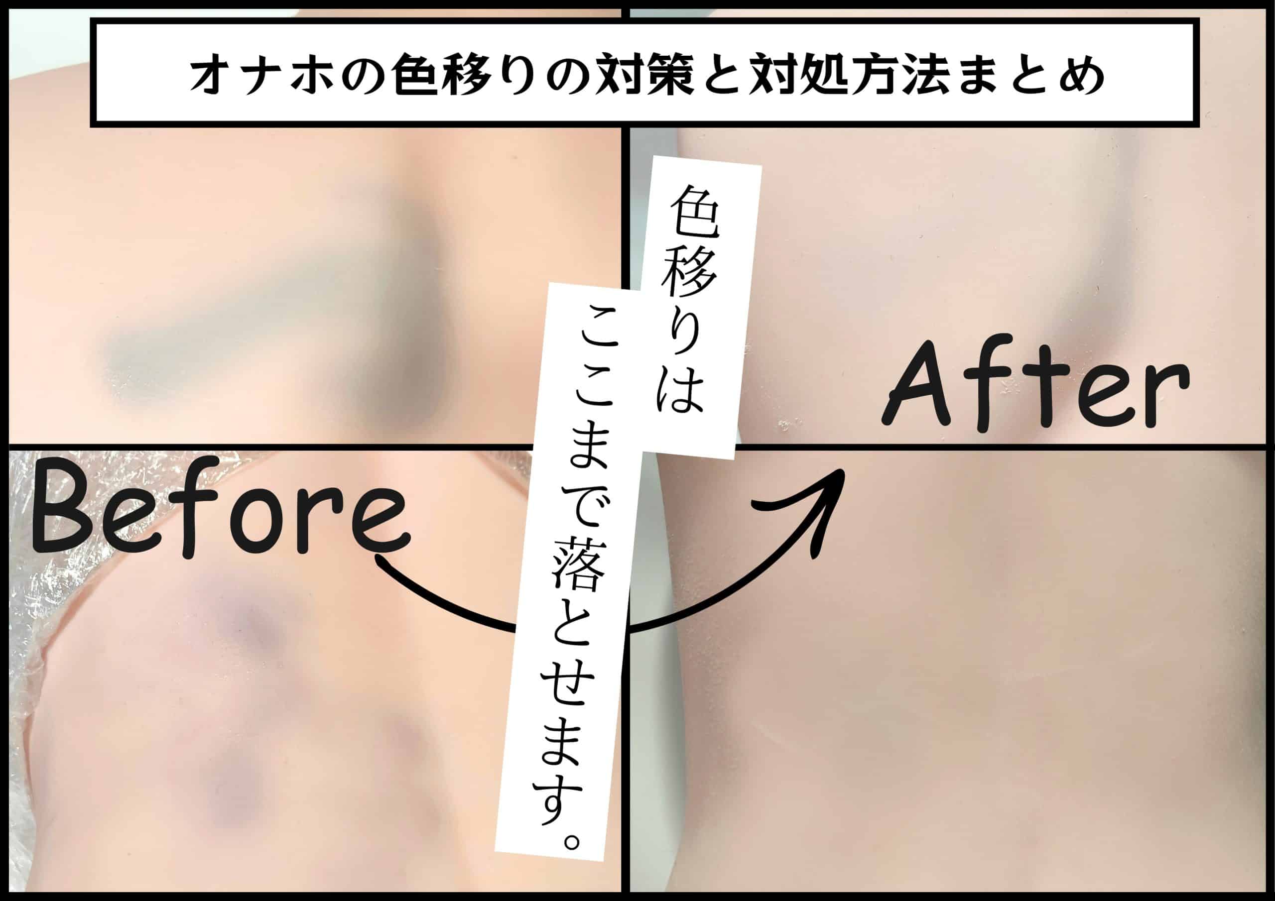 装飾パーツ