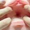 oplus