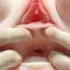 oplus